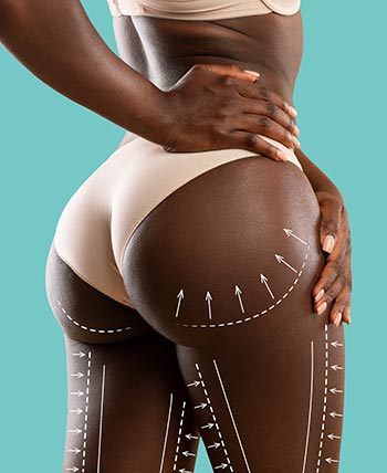 Brazilian Butt Lift Near Me in Schaumburg, IL Brazilian Butt Lift Near Me in Schaumburg, IL
