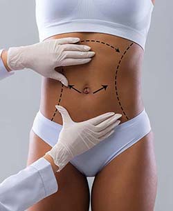 Cellulite Treatment by Aveli Near Me in Schaumburg, IL Cellulite Treatment by Aveli Near Me in Schaumburg, IL