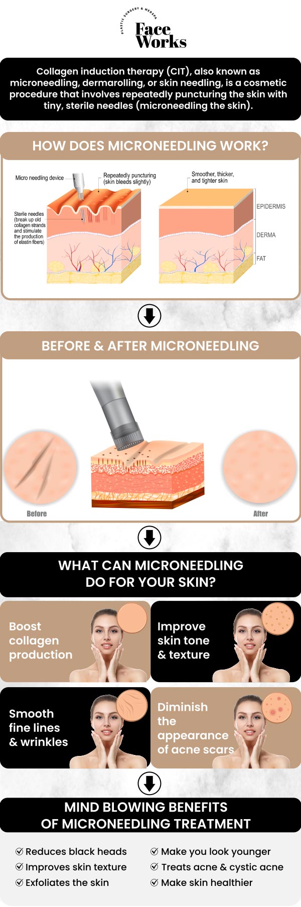 PRP microneedling is a cutting-edge treatment that combines microneedling with platelet-rich plasma (PRP) to rejuvenate the skin and reduce signs of aging. By stimulating collagen production it helps minimize wrinkles, scars, and fine lines. Under the expert care of our specialists, you can achieve refreshed, youthful skin with personalized treatment tailored to your needs. For more information, contact us or request an appointment online. We are conveniently located at 501 W Golf Rd A, Schaumburg, IL 60195. PRP microneedling is a cutting-edge treatment that combines microneedling with platelet-rich plasma (PRP) to rejuvenate the skin and reduce signs of aging. By stimulating collagen production it helps minimize wrinkles, scars, and fine lines. Under the expert care of our specialists, you can achieve refreshed, youthful skin with personalized treatment tailored to your needs. For more information, contact us or request an appointment online. We are conveniently located at 501 W Golf Rd A, Schaumburg, IL 60195.