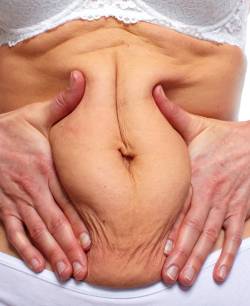 Non-Surgical Near Me in Schaumburg, IL Non-Surgical Near Me in Schaumburg, IL