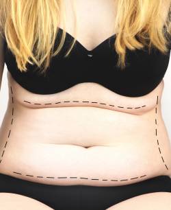 Surgical Under Anesthesia Near Me in Schaumburg, IL Surgical Under Anesthesia Near Me in Schaumburg, IL