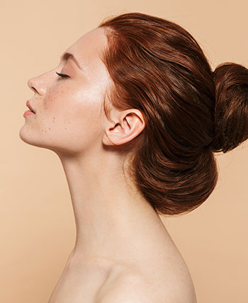 Jawline with Fillers Near Me in Schaumburg, IL Jawline with Fillers Near Me in Schaumburg, IL