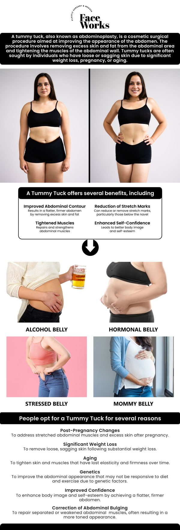 At Face Works Plastic Surgery, our skilled team offers expert mini tummy tuck procedures to help you achieve a firmer, flatter abdomen with minimal downtime. We specialize in contouring the lower abdominal area by removing excess skin and tightening underlying muscles. Ideal for individuals with mild to moderate abdominal concerns, our approach delivers natural-looking results with a shorter recovery period. For more information, contact us or request an appointment online. We are conveniently located at 501 W Golf Rd A, Schaumburg, IL 60195. At Face Works Plastic Surgery, our skilled team offers expert mini tummy tuck procedures to help you achieve a firmer, flatter abdomen with minimal downtime. We specialize in contouring the lower abdominal area by removing excess skin and tightening underlying muscles. Ideal for individuals with mild to moderate abdominal concerns, our approach delivers natural-looking results with a shorter recovery period. For more information, contact us or request an appointment online. We are conveniently located at 501 W Golf Rd A, Schaumburg, IL 60195.