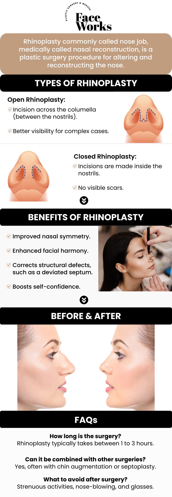 At FaceWorks, our team of providers in Schaumburg, IL, is dedicated to providing personalized care and achieving natural-looking results. Whether you're seeking to enhance the aesthetic of your nose or improve function, we use advanced techniques tailored to your unique needs. Our skilled surgeons prioritize both form and function, ensuring optimal results with minimal recovery time. For more information, contact us or request an appointment online. We are conveniently located at 501 W Golf Rd A, Schaumburg, IL 60195. At FaceWorks, our team of providers in Schaumburg, IL, is dedicated to providing personalized care and achieving natural-looking results. Whether you're seeking to enhance the aesthetic of your nose or improve function, we use advanced techniques tailored to your unique needs. Our skilled surgeons prioritize both form and function, ensuring optimal results with minimal recovery time. For more information, contact us or request an appointment online. We are conveniently located at 501 W Golf Rd A, Schaumburg, IL 60195.