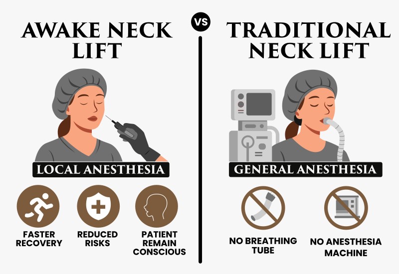 Awake Face Lift VS Traditional Neck Lift