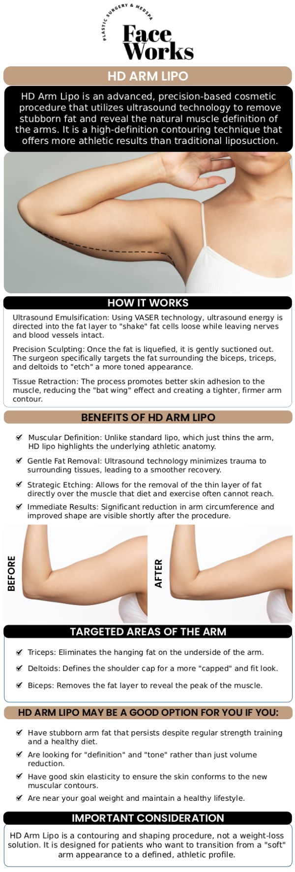 At FaceWorks, we believe that beautiful arms aren't just about losing volume—they’re about revealing the underlying muscle architecture. Our HD Arm Lipo 360 approach goes beyond traditional liposuction by treating the arm as a three-dimensional cylinder. We meticulously sculpt the shoulder (deltoid) transition, the triceps area, and the bicep curvature to eliminate "bat wings" while highlighting athletic definition. For more information, contact us or book an appointment online. We are conveniently located at 501 W Golf Rd A, Schaumburg, IL 60195.