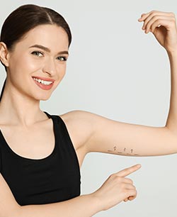 HD Arm Lipo 360 Near Me in Schaumburg, IL HD Arm Lipo 360 Near Me in Schaumburg, IL
