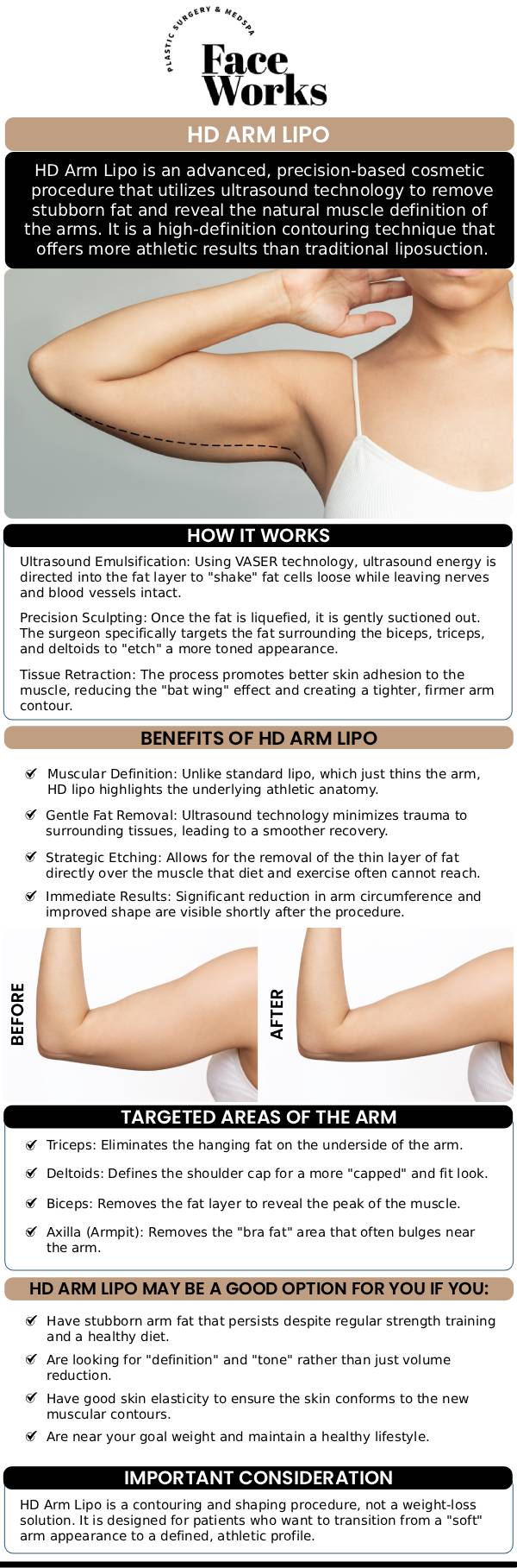Our team at Face Works Plastic Surgery offers HD Arm LIPO, a precision body contouring procedure that targets stubborn fat in the arms for a sleek, toned look. Using advanced techniques, Dr. Dillon helps patients achieve a more sculpted arm appearance, with results that are natural, smooth, and long-lasting. For more information, contact us or book an appointment online. We are conveniently located at 501 W Golf Rd A, Schaumburg, IL 60195. Our team at Face Works Plastic Surgery offers HD Arm LIPO, a precision body contouring procedure that targets stubborn fat in the arms for a sleek, toned look. Using advanced techniques, Dr. Dillon helps patients achieve a more sculpted arm appearance, with results that are natural, smooth, and long-lasting. For more information, contact us or book an appointment online. We are conveniently located at 501 W Golf Rd A, Schaumburg, IL 60195.