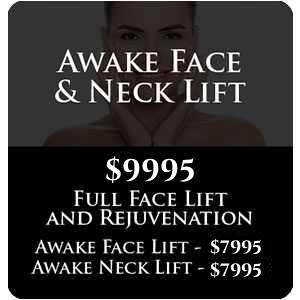 Awake Face & Neck Lift