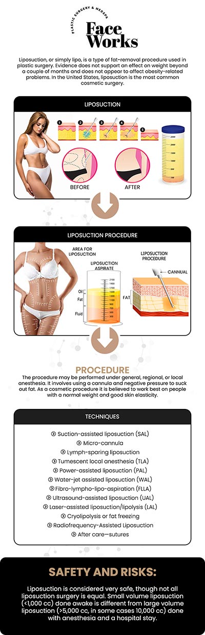 At Face Works Plastic Surgery, our dedicated team is proud to offer advanced awake body liposuction to help you eliminate stubborn fat and achieve your desired aesthetic goals safely. This minimally invasive approach utilizes local anesthesia, allowing you to remain completely comfortable and conscious while we meticulously sculpt your body. For more information, contact us or book an appointment online. We are conveniently located at 501 W Golf Rd A, Schaumburg, IL 60195. At Face Works Plastic Surgery, our dedicated team is proud to offer advanced awake body liposuction to help you eliminate stubborn fat and achieve your desired aesthetic goals safely. This minimally invasive approach utilizes local anesthesia, allowing you to remain completely comfortable and conscious while we meticulously sculpt your body. For more information, contact us or book an appointment online. We are conveniently located at 501 W Golf Rd A, Schaumburg, IL 60195.